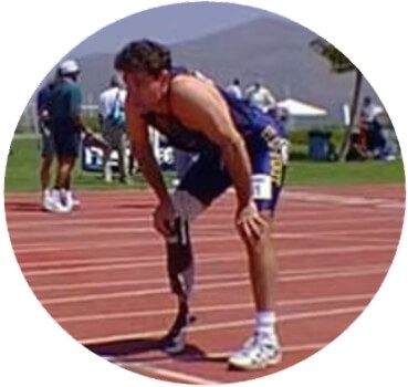 Amputee Walking School Training