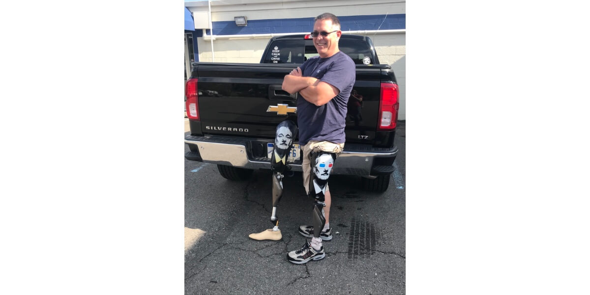  | Amputee Walking School